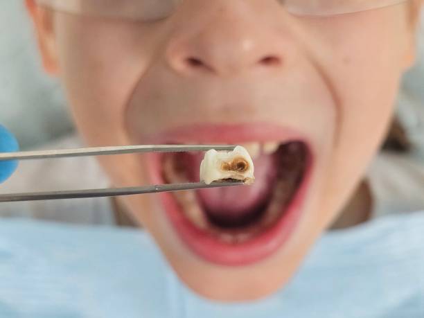 Best Emergency Dental Care for Trauma or Injury in Elkins, WV