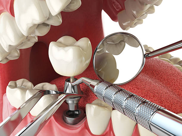 Best Emergency Broken Tooth Repair in Elkins, WV